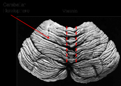 Vermis (wormlike) - the midline region of the cerebellum
The hemispheres, left and right, are on either side of the vermis