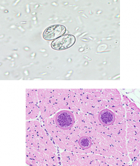 life cycle sim to toxoplasma
eat undercooked beef or pork
oocysts - 2 sporocysts (top)
body walls off (bottom)