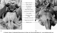 Crus cerebri, cranial nerves III and IV
Other landmarks: Optic chiasm, mammilary bodies, infundibular Stalk