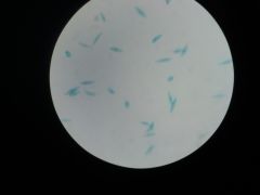 long thin body with flagella (not always visible microscope)