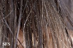 piedra - אבן בלטינית.
המחלה פוגעת בגוף השיערה (hair shaft)
על פי הספר המקור הוא טריכופסופרון בייגלי. לפי שמר היום ידוע שזה טריכוספורון ovoides. 
מיקו...