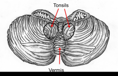 Tonsils - lobules of the hemisphere that lie above the foramen magnum
They may be herniated through the foramen magnum by increased intracranial pressure
This is bad, why? - increase pressure - herniate and die