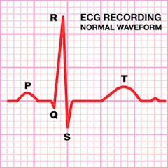 ECGs measure the electrical activity of the heart


P = atria contract
QRS = Ventricles contract
T = ventricles relax