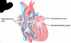 Pulmonary vein brings deoxygenated blood to left atrium moves through bicuspid valve which has a more robust myocardium (because it pumps blood to the entire body)
Blood passes through the bicuspid valve (left AV valve)