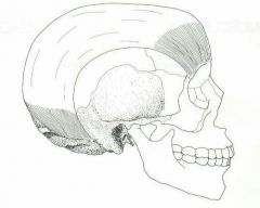 Epicranial aponeurotica