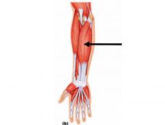 Flexes middle phalanx of each finger, proximal phalanx of each finger, and hand