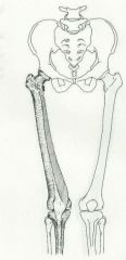 Linea aspera of femur