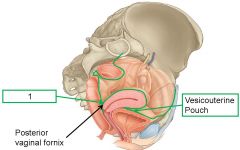 What is denoted by label 1 on this sagittal view of the female pelvic viscera?