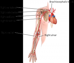 Subclavian turns into:
Axillary --> Bracial --> Radial and Ulnar Arteries