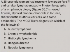 A 25-year-old woman had recurrent low grade fever 
and cervical lymphadenopathy. Photomicrographs 
of a lymph node biopsy (Figure G6.7) showed 
fibrosis, atypical mononuclear cells in lacunae, 
characteristic multinuclear cells, and some 
eos...
