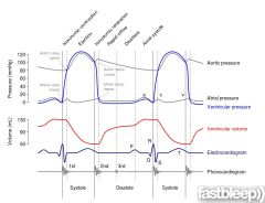 four heart sound heard, ECG diagram