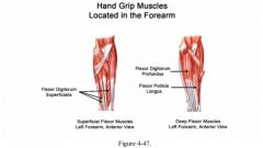 Flexion at proximal interphalangeal, metacarpophalangeal and wrist joints