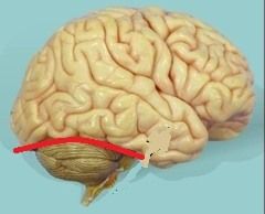 separates cerebral hemispheres from cerebellum