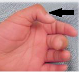 17.  Which standard unit is about as long as your thumb, from  your knuckle to the fingernail tip?