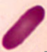 Elliptocyte
- Hereditary elliptocytosis