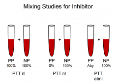 Mixing study: take a patients plasma and normal plasma and mix them together.