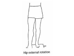 Rotating the hip out/away from the body