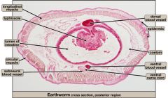 cuticle, epidermis, circular muscle, longitudinal muscle, coelom, intestine, typhosole, dorsal blood vessel, ventral blood vessel, ventral nerve cord, nephridium