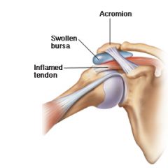 - 8 to 9 in shoulder area- found in areas subject to friction- most common bursa is subacromial bursa* located below acromion process* protects supraspinatus from acromion process  