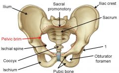What is denoted by label 1 on this anterior image of the female pelvis?