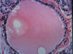 medium magnification of ____ ____, showing a ____ follicle lined by a ____ _____ epithelium. The ___ changes depending on the activity of the gland. In an active gland, the epithelium exhibit a more squamous appearance.
