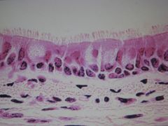 high magnification of a respiratory epithelium in the ___. The luminal epithelium is ___ ____ ciliated. ____ line the apices of the darker cells. The light staining, round cells are ____ that are filled with ____. Inferior to the respiratory epith...
