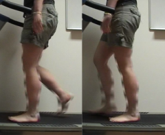 3. Mid stance
•Period from when opposite foot leaves the ground to heel rise of the foot
•Represents ~10-30% of the total gait cycle•COM moves over stance leg
•Period of SLS