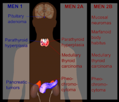 PARAthyroid neoplasia!! = 1 & 2A which means you would see HYPERCALCEMIA, and more kidney stones


MEN2B = MARFAN like syndrome