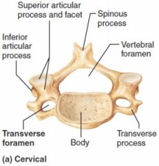 -Vertebral Foramen
-Vertebral Body
-Spinous Process