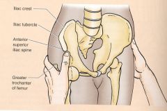 -ASIS (Anterior Superior Iliac Spine
-Iliac Spine
-Ischial Spine