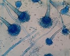 Aspergillus fumigatus

[Microscopically the organism grows as septate hyphae, branching at 45º angles]