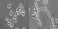 Candida albicans

[Although a yeast, it can form pseudohyphae in infected tissue and form characteristic germ tubes at 37ºC under laboratory conditions]