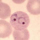Protozoa:

Transmitted by the female Anopheles mosquito, with infection of RBCs and hepatocytes