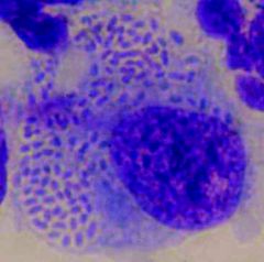 Klebsiella granulomatis
(formerly Calymmatobacterium granulomatis)

[Diagnosis is based on finding intracellular organisms aggregated as 'Donovan Bodies"]