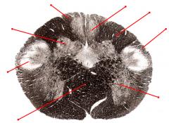 Identify the tagged structures and the location in the brain of the section