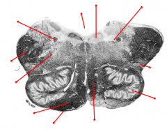 Identify the tagged structures and the location in the brain of the section