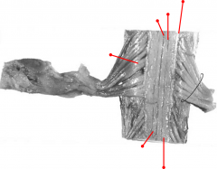 Identify the tagged structures, and the location in the spinal cord, if applicable