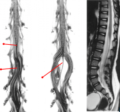 Identify the tagged structures, and the location in the spinal cord, if applicable