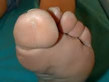 big toe