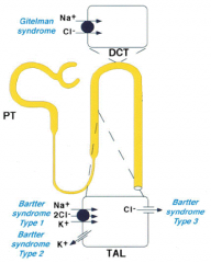 - Bartter Syndrome Type 1
- Loop Diuretics: Furosemide, Ethacrynic Acid, Bumetanide