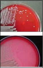 what is antigenic and relatively specific for S. aureus (contained in the cell wall of S. aureus)?