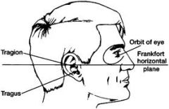 An imaginary line drawn from the superior portion of the cartilaginous external auditory canal through the infraorbital rib. 
On lateral photographs, the plane can be approximated by having the patient orient their head so that a plane from the s...