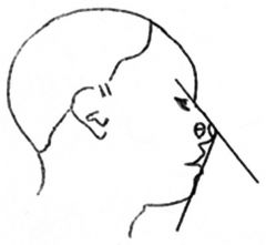 Which facial angle is this?

What is the ideal angle?