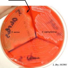 What organisms show beta-hemolysis on sheep blood agar?