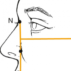 line drawn through the nasion that is perpendicular to the Frankfort horizontal plane. Indicates the relative amount of upper, middle, and lower face retrusion and protrusion