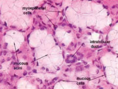 -Stellate-shaped
-cytoplasm is difficult to distinguish with LM
-with EM, they resemble smooth muscle cells and are contractile