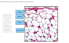 adipose connective tissue