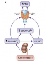 - ↑ Serum PO4 (increased retention)
- ↓ 1,25-Dihydroxy-Vitamin D
- ↓ Serum Ca2+

- Decreased calcitriol production  ↓ Ca2+ absorption, hypocalcemia

Leads to ↑PTH release (2° Hyperparathyroidism)