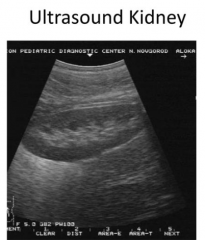 Ultrasound or CT