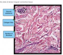 dense irregular connective tissue